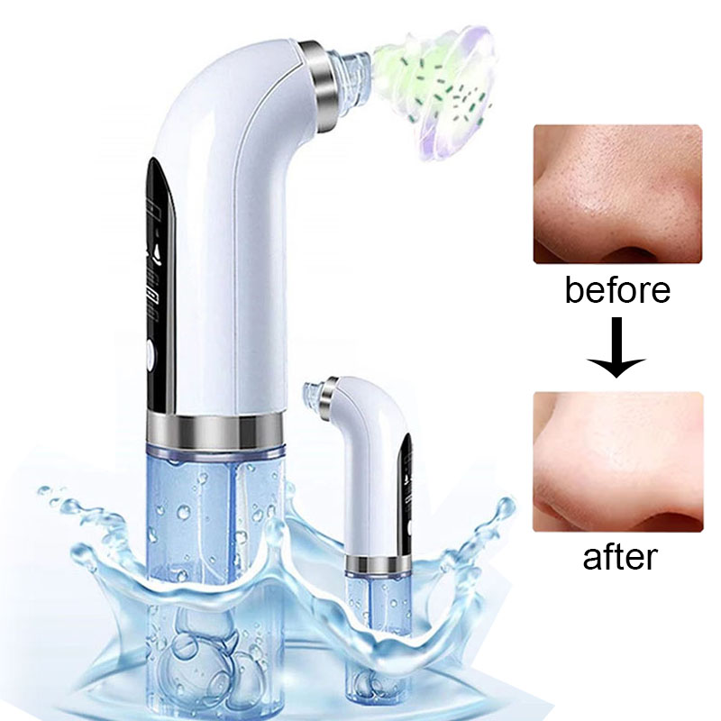 Wasser Dermabrasion Hydra Peel – Air Bubble Remover Bewertung und Preis
